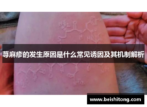 荨麻疹的发生原因是什么常见诱因及其机制解析