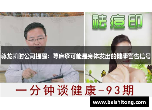 尊龙凯时公司提醒：荨麻疹可能是身体发出的健康警告信号